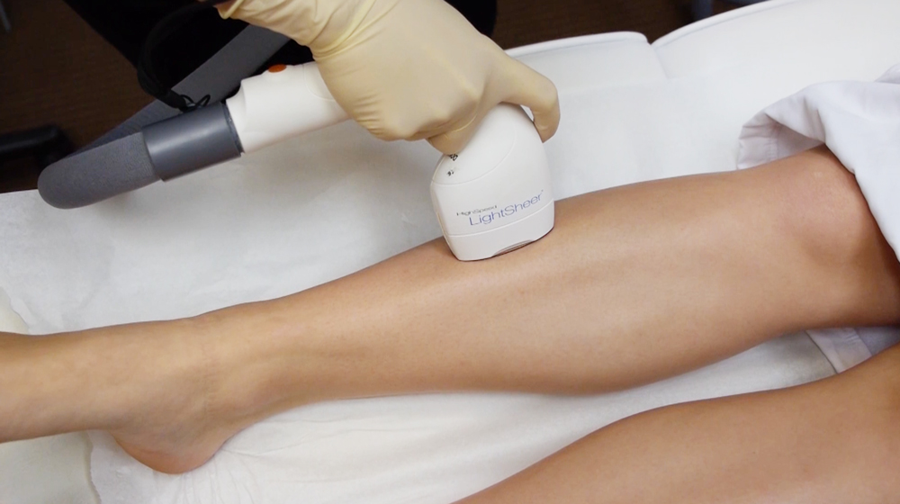 Laser Hair Removal Mequon | Permanent Hair Removal